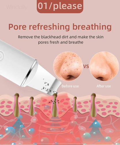Ultrasonic Skin Scrubber – Deep Clean & Lift
